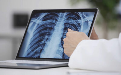 Schleim in den Bronchien – was tun?