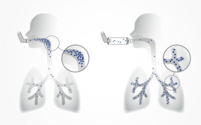 Das bewirkt eine Inhalierhilfe (Spacer)