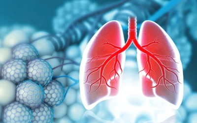 Bronchiektasen – Ursachen, Symptome und Behandlung